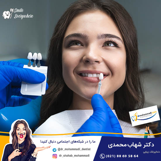 فیلم لمینت دندان بدون تراش - کلینیک دندانپزشکی دکتر شهاب محمدی